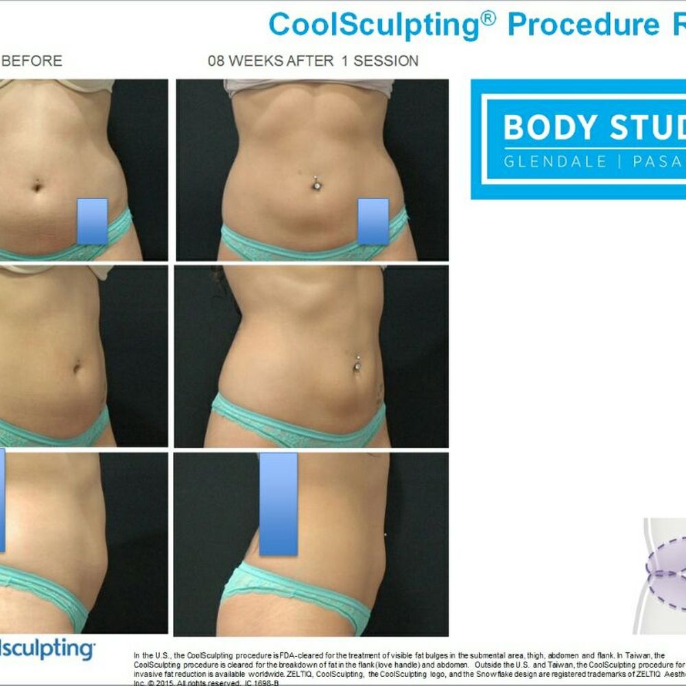 Best Weight Loss Clinic Center Burbank California