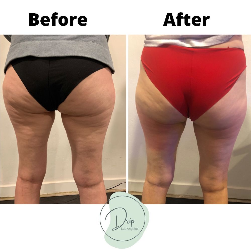 Best Weight Loss Clinic Center Burbank California