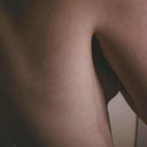 Photo Weight Loss Clinic Chandler Az